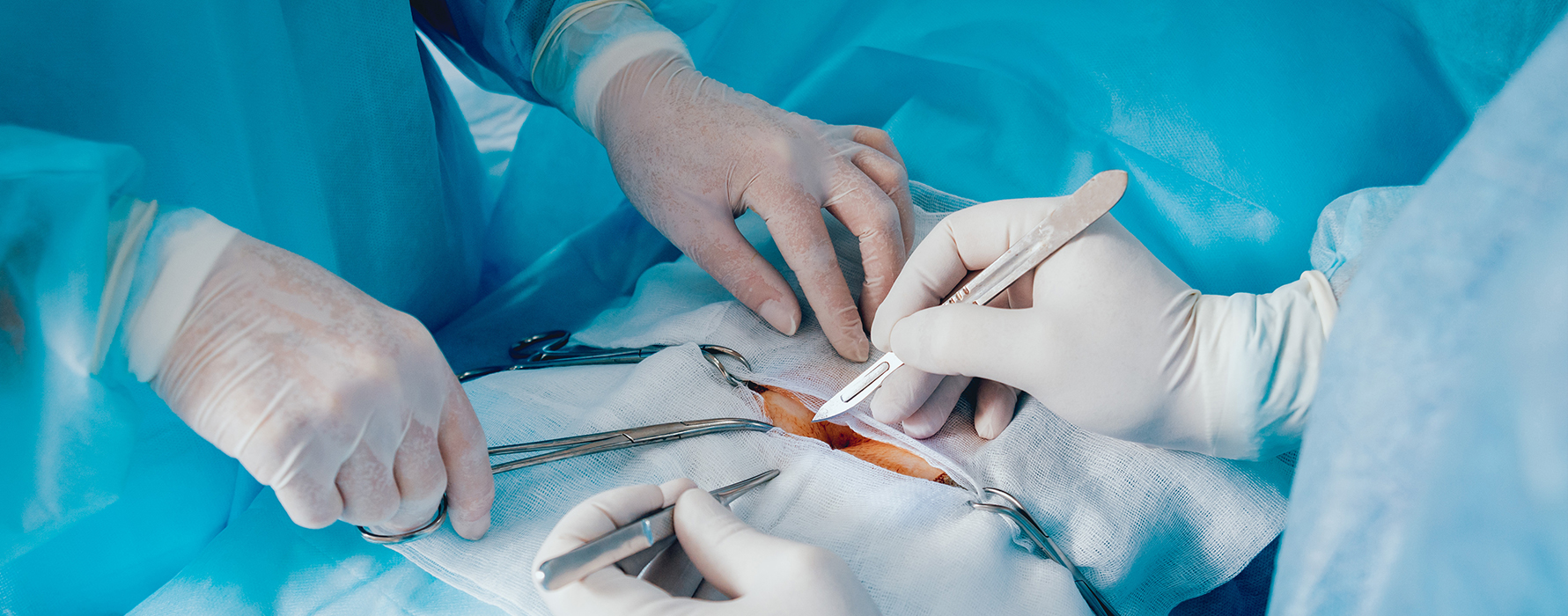 Dr. Volkan Arayıcı leitet die Magenverkleinerung Türkei Beste klinik